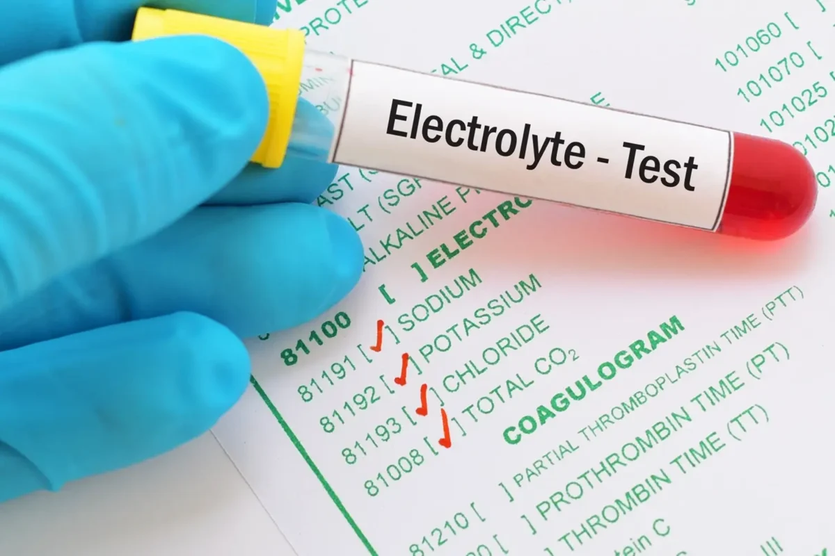 Electrolyte Monitoring