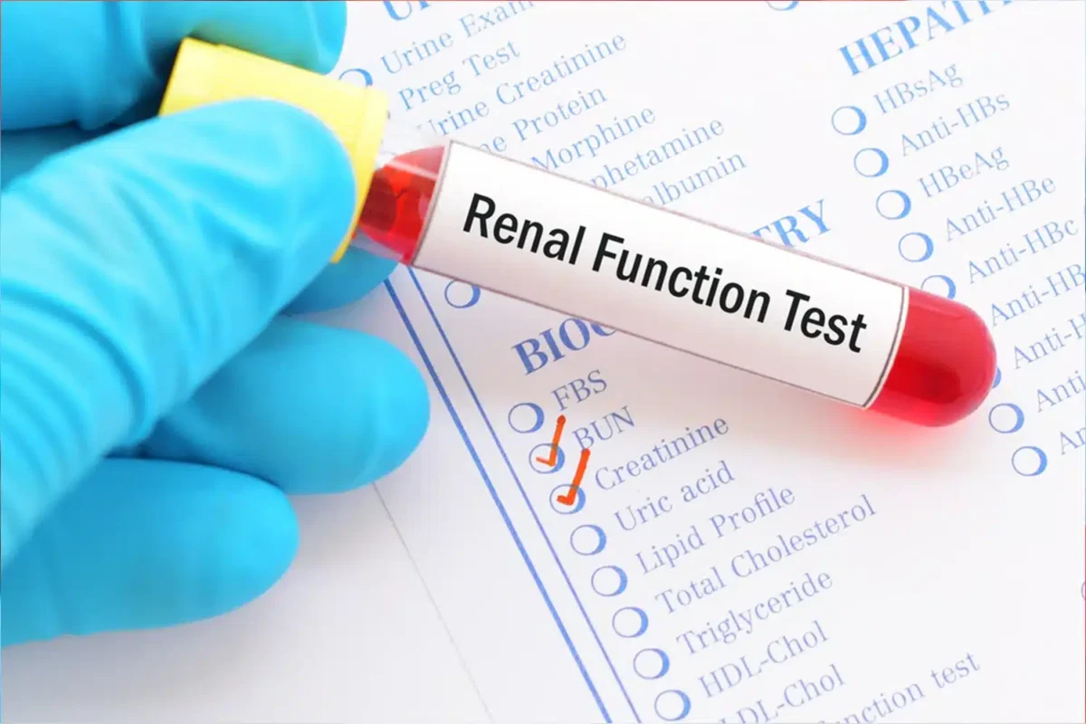 Renal Function Tests
